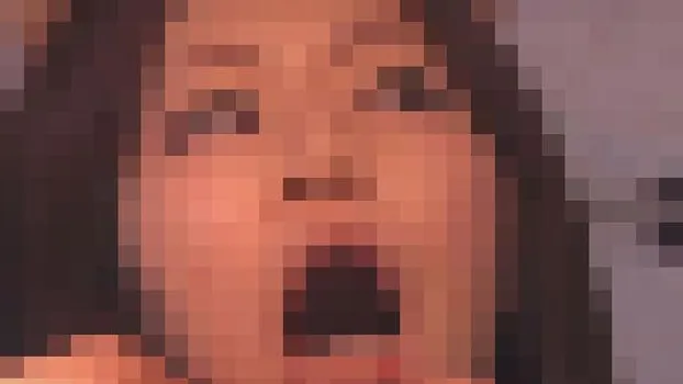 美容歯科診療盗撮2